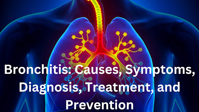 Understanding Bronchitis: Causes, Symptoms, Diagnosis, Treatment, and Prevention