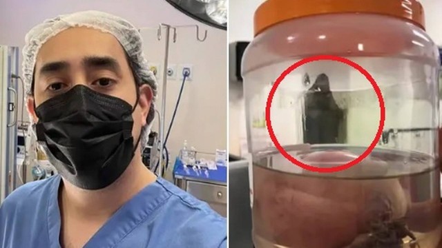 Médico flagra "fantasma da morte" após cirurgia. Veja! | Brazil News Informa