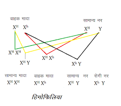 हिमोफिलिया