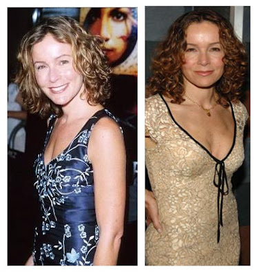 Jennifer Aniston Plastic Surgery Before After. Jennifer Grey Before And After