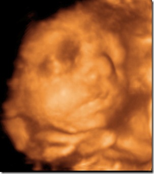 BABY_10