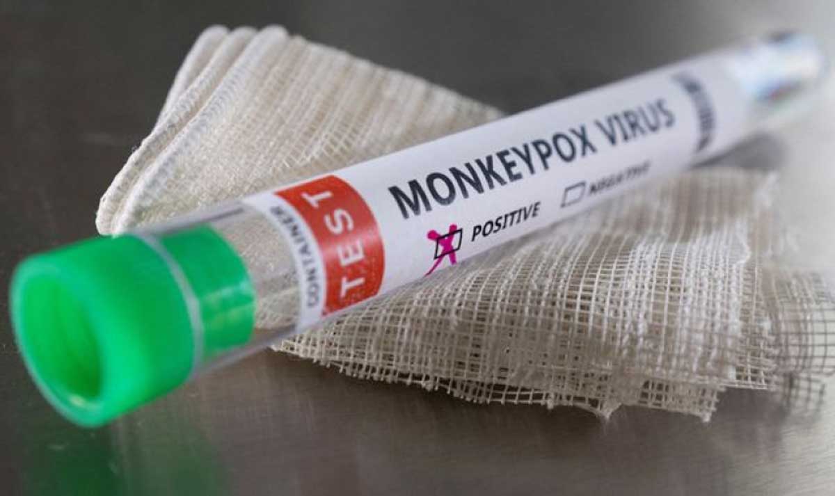 Monkeypox is spreading rapidly in America, 7 thousand cases