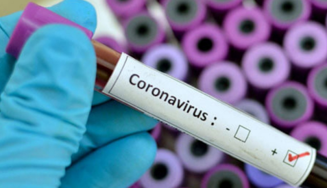 تارودانت بريس :   تسجيل 10 إصابات جديدة بفيروس كورونا بجهة سوس ماسة  | Taroudant Press