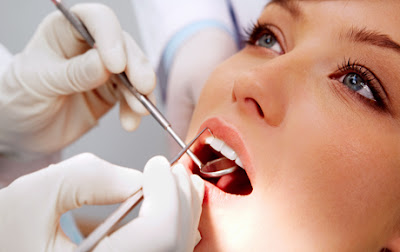Cách chữa răng bị mẻ bằng hàn trám có đau hay không?