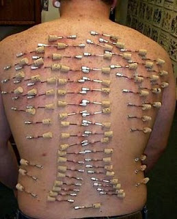 http://allaboutbodyart.blogspot.com/- In most Extreme Body Piercing -Scarification