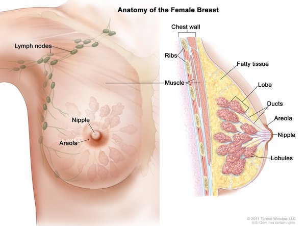 سرطان الثدي: الاسباب و الاعراض و العلاج