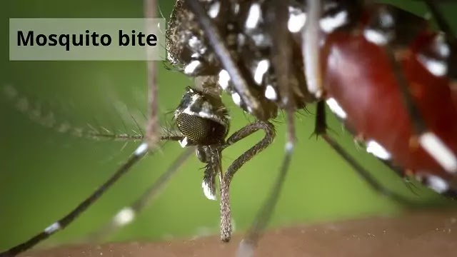 मच्छर द्वारा फैलाए जाने वाले रोग(diseases spread by mosquitoes)|hindi