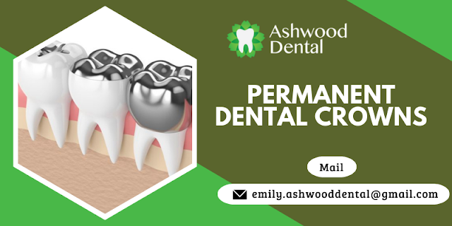 Get A Permanent Crown