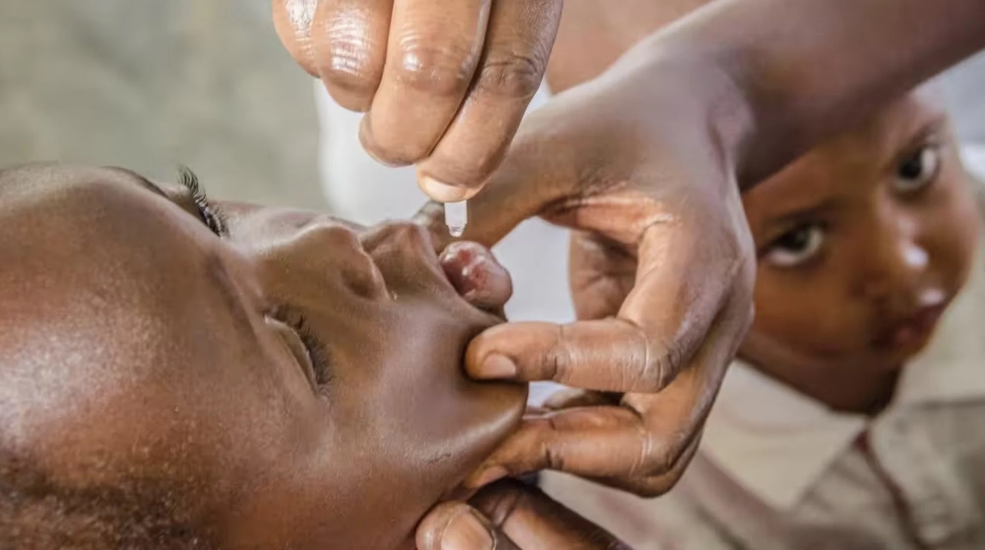African Country Burundi Detects Polio Outbreak Linked to Polio Oral Vaccine – Vaccine-Induced Polio is Now More Prevalent than the Wild Type