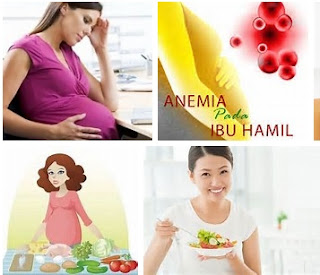 anemia pada ibu hamil