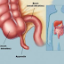 Features of Appendicitis Pain You must Beware