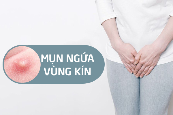 Ngứa và nổi mụn ở vùng kín