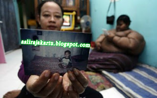 HEBOH!!! Recor Anak Terberat Ternyata Berasal Dari Indonesia