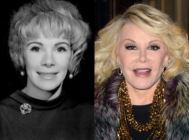 Joan Rivers Worst Plastic Surgery