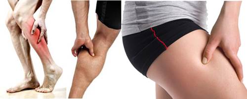 Tipos de dolores musculares que se experimentan al trotar o correr