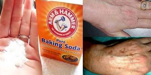 PAKAI BAKING SODA, WAJAH AKAN PUTIH !!!