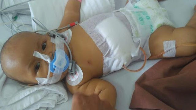  Dalam Tubuh Mungilnya, Organ Hati Bayi Tiwi Hampir Tak Berfungsi Lagi