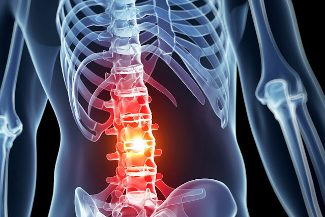 Spinal Imaging