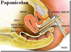 Papanicolau