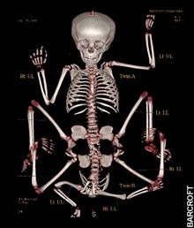 Lakshmi Tatma's X-ray