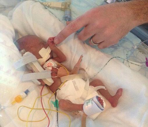 baby born at 27 weeks