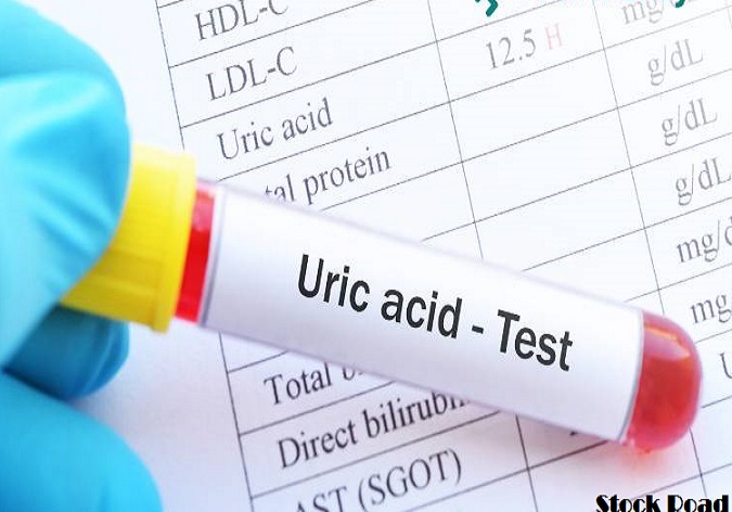 यूरिक एसिड से हैं परेशान? खाने में शामिल करें ये मसाले, खून होगा साफ (Are you troubled by uric acid? Include these spices in your food, blood will become clean)