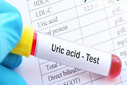 यूरिक एसिड से हैं परेशान? खाने में शामिल करें ये मसाले, खून होगा साफ (Are you troubled by uric acid? Include these spices in your food, blood will become clean)