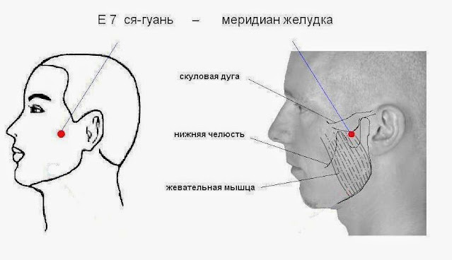 Иррадиация боли в челюсть. Схема зоны аппликации аппликатором Ляпко. Схема измерения входа в суставную ямку ВНЧС. Нижняя височная область.