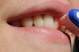 Higiena jamy ustnej przy implantach