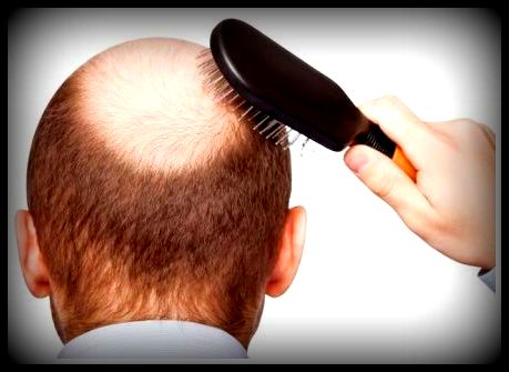 Step by step methods to stop the hair fall