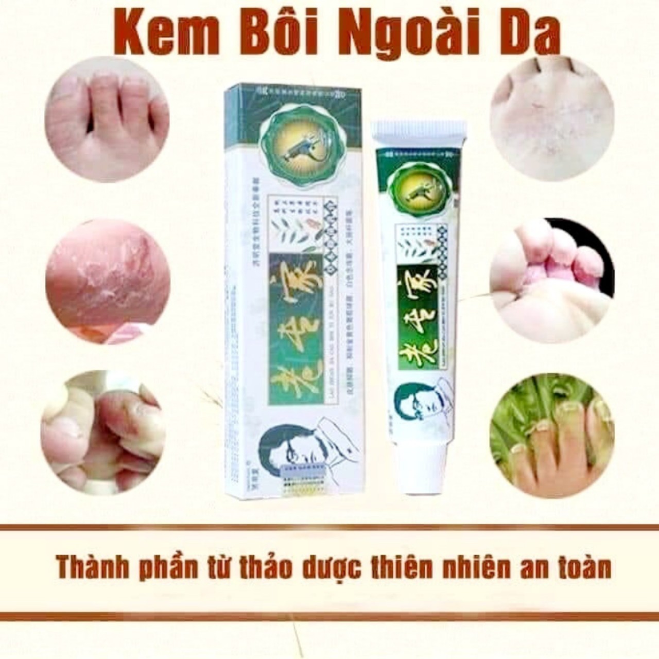 Kem Bôi Á Sừng, Ngứa Khô Da, Nứt Nẻ Tay Chân kem trị ghẻ, nấm ngứa, hắc lào Eilyshop