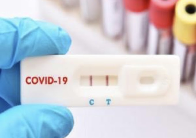 Coronavirus: i dati e gli aggiornamenti del 12 agosto