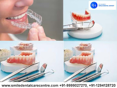 Best Invisible Aligner Treatment