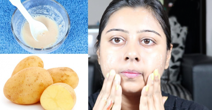 Here's How I Clear My Face With Potato