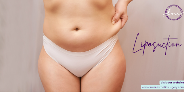 Trends and Popularity of Liposuction in Beverly Hills