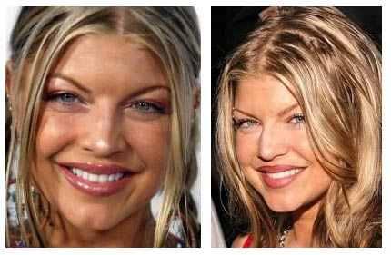pictures of lady gaga before plastic surgery. Fergie Before Plastic Surgery