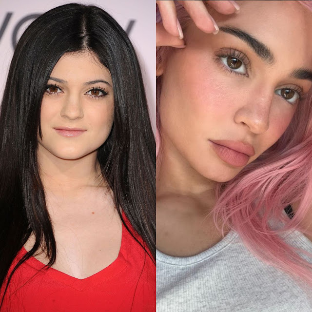 Kylie Jenner antes (2009) vs ahora (2024)