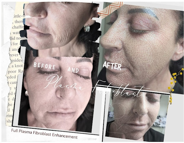 full face enhancement