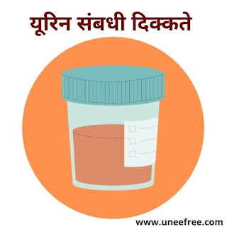 Dehydration-Symptoms-शरीर-में-पानी-की-कमी-से-होने-वाले-लक्षण-Dehydration-के-लक्षण-हिंदी-में