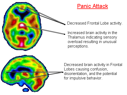 Panic Attack Symptoms Stress : Spiritual Healing Of Panic And Anxiety Disorders