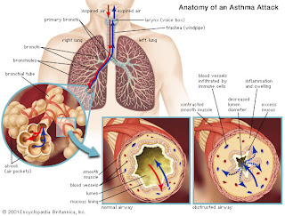 cara alami atasi asma