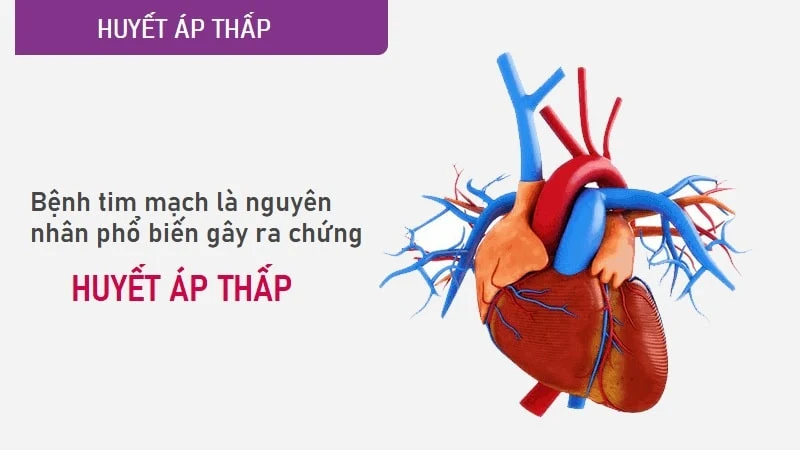 Bệnh tim mạch là nguyên nhân phổ biến gây ra huyết áp thấp