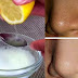 Only 2 Ingredients And The Pores On Your Face Will Disappear Forever!