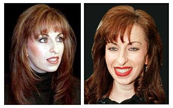 Paula Jones Nose Job