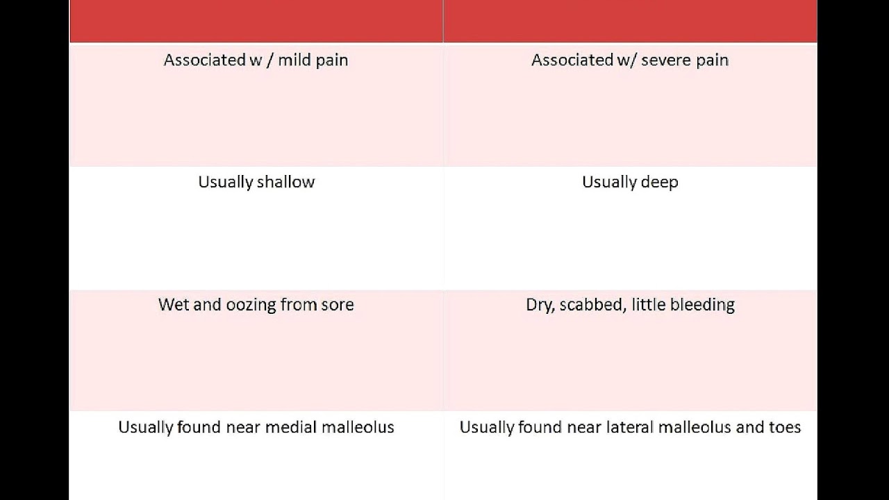 Treatment For Venous Ulcer