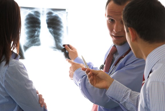 Mesothelioma and Asbestos Lawyers