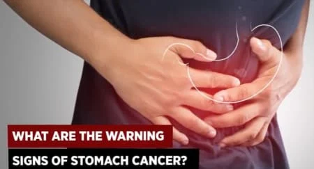 What Are The Early Warning Signs Of Stomach Cancer