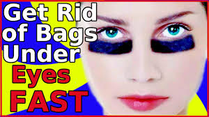 how to get rid of bags under eyes