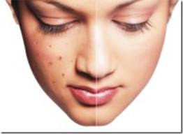 COMO ELIMINAR ESPINILLAS DEL ROSTRO tipsparaestarbellas.blogspot.com/