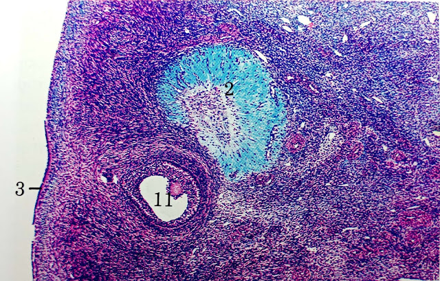 Ovary of cow, Corpus Albicans